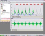 example of EMG data